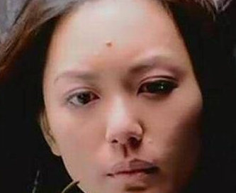 痣的位置代表什么意思 痣的位置代表什么意思